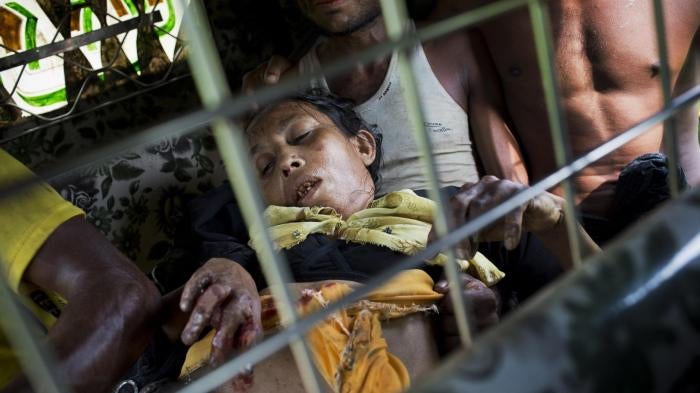 A Rohingya woman travels to a hospital near Kutupalong, Bangladesh, after a landmine blew off her right leg while she was crossing the border from Burma, September 4, 2017.