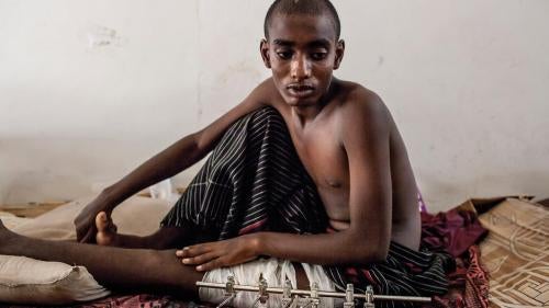 Yemen's Torture Camps: Abuse of Migrants by Human Traffickers in a