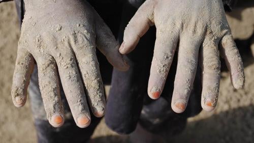 Helal, 10, works as a brick maker at a brick kiln outside Kabul. He told Human Rights Watch that the brick mold is heavy and his hands hurt working with wet clay. Helal doesn’t go to school because he has to work. 