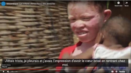 201906DRD_Mozambique_albinism_VideoFR