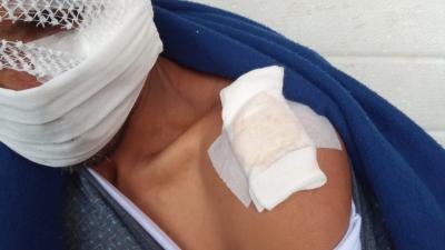 A migrant sustained severe head injury and a broken arm following a brutal beating by, what he stated was, six Croatian police officers during a pushback on October 16, 2020. 