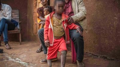 Un garçonnet de 6 ans, né à proximité de la mine d’or de Lega Dembi, dans la région éthiopienne de l’Oromia, n’a pas d’os dans le pied droit et seulement trois orteils au pied gauche.  © 2020 Tom Gardner