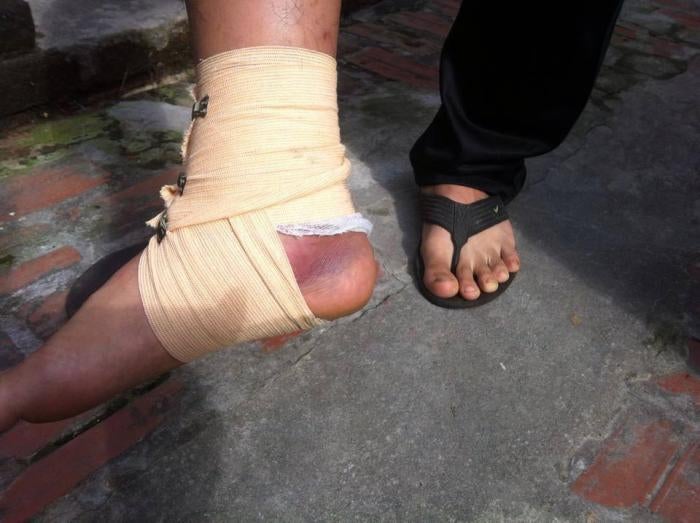 Ly Quang Son&rsquo;s foot after being assaulted in Nghe An on December 6, 2015.