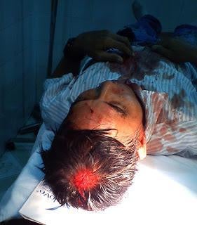 Huynh Cong Thuan after being assaulted in Ho Chi Minh City on September 8, 2011.