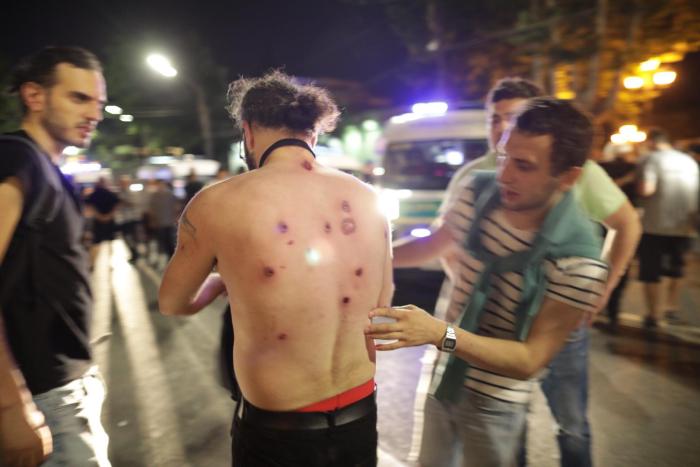 Georgia: Police Use Teargas, Rubber Bullets Against Protesters