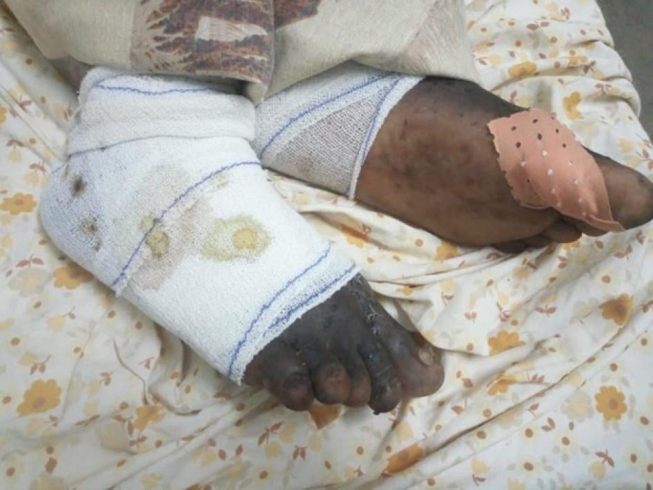 Les pieds bandés d’un homme de 65 ans qui a été blessé lors de l’attaque menée par Boko Haram à Nguetchéwé, dans la région de l’Extrême-Nord du Cameroun, dans la nuit du 1er au 2 août 2020. Photo prise dans l’Hôpital de Mokolo, situé dans la même région, le 10 août 2020. 