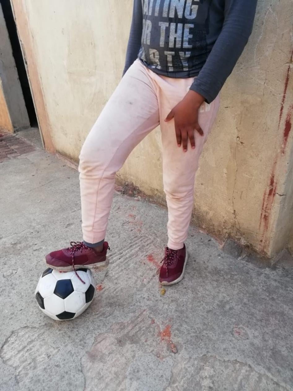 Keshia, une jeune fille née à Johannesburg (Afrique du Sud) de parents congolais, pose son pied sur un ballon de football près du domicile familial, en août 2020.  ©2020 Privé