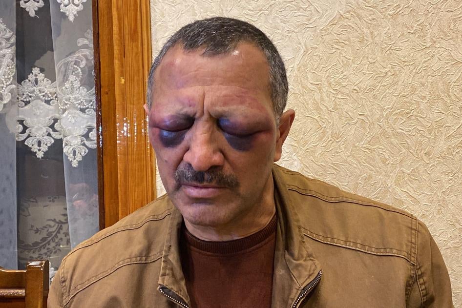 Tofig Yagublu, a prominent opposition leader and ardent government critic, at his home, after policemen severely beat him on December 1, 2021.