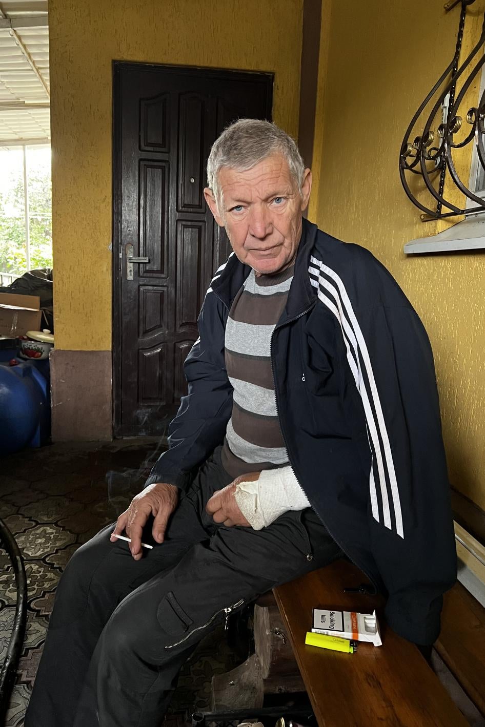 Mykhailo Ivanovych, 67, who was detained in late August 2022 for 12 days. A soldier broke his left arm when he hit him with what Mykhailo Ivanovych thought was a plastic pipe, Izium, Ukraine, September 23, 2022.