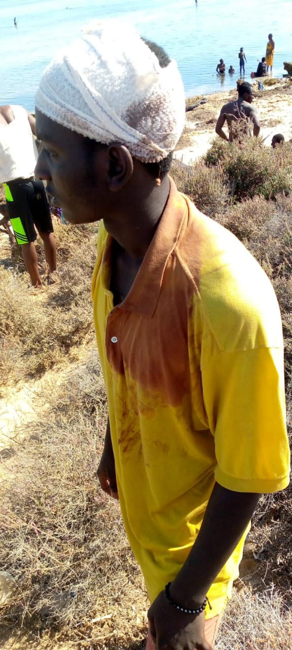 A man expelled to the Libyan border by Tunisian authorities on July 5, 2023 shows his head injury and bloody shirt.