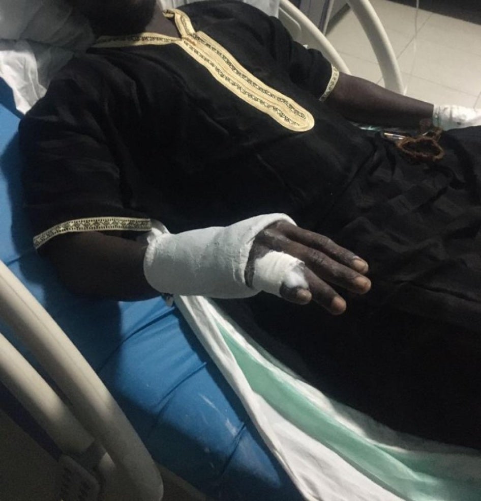 Un membre du PASTEF âgé de 28 ans, arrêté par les gendarmes à Mbour, dans la région de Thiès au Sénégal, lors d'une manifestation pro-opposition tenue le 1er juin 2003, montre son doigt cassé ; il affirme avoir subi cette blessure, parmi d’autres, lors d’une séance de tortures ayant duré plusieurs heures.