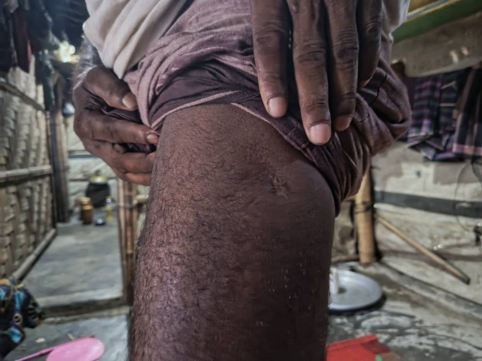 photo injuries on an unidentified man