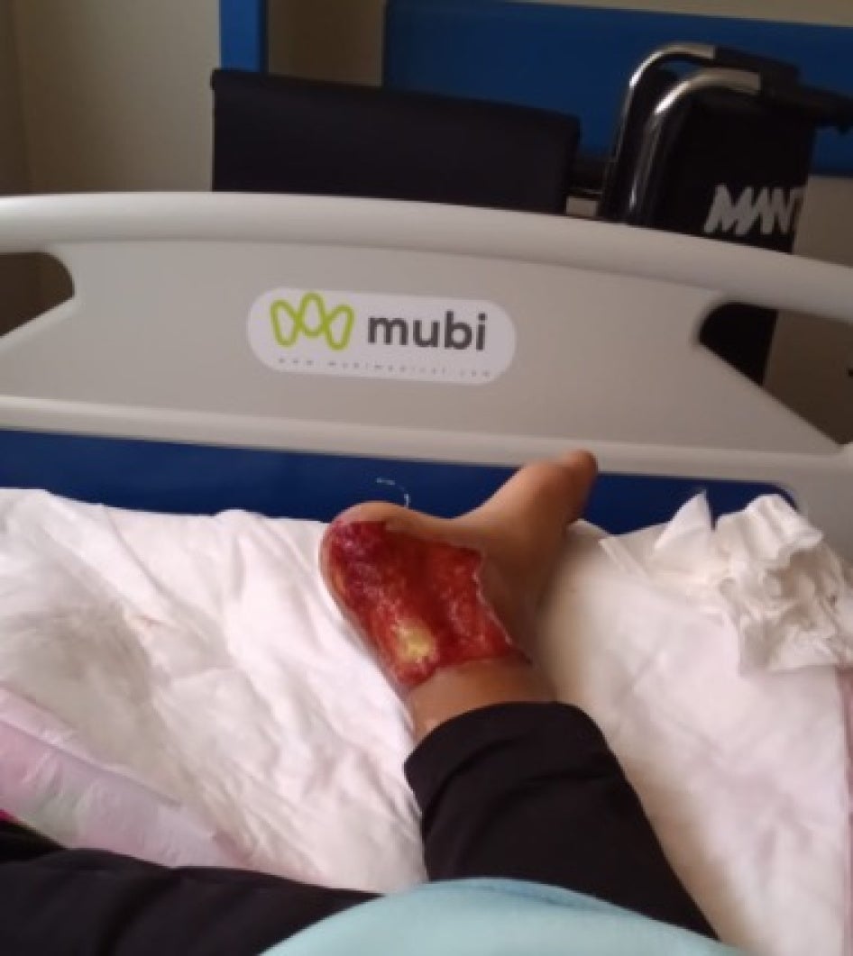 photo of an injured foot
