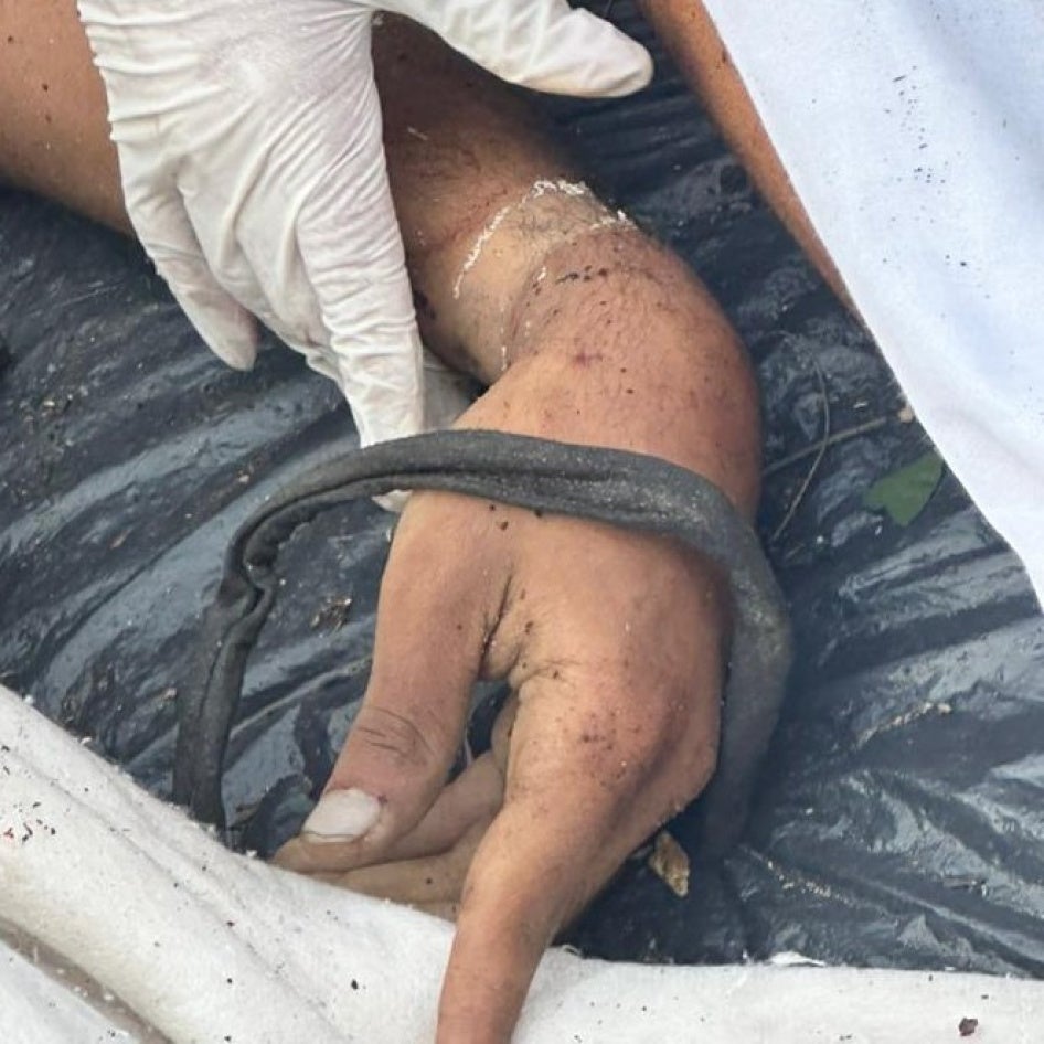 close-up photo of the wrist of a deceased man