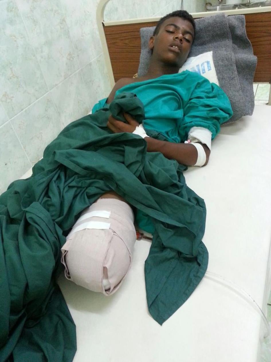وائل خالد محمد الرُجاع، 15 عاما، فقد ساقه اليسرى في انفجار لغم أرضي قرب مطار عدن الدولي في 12 أكتوبر/تشرين الأول 2015.