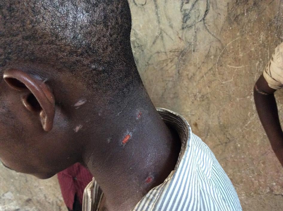 A 20-year-old Batwa man was beaten with sticks by Luba militia fighters after he tried to leave the Cotanga site and walk around Nyunzu town in southeastern Democratic Republic of Congo. 