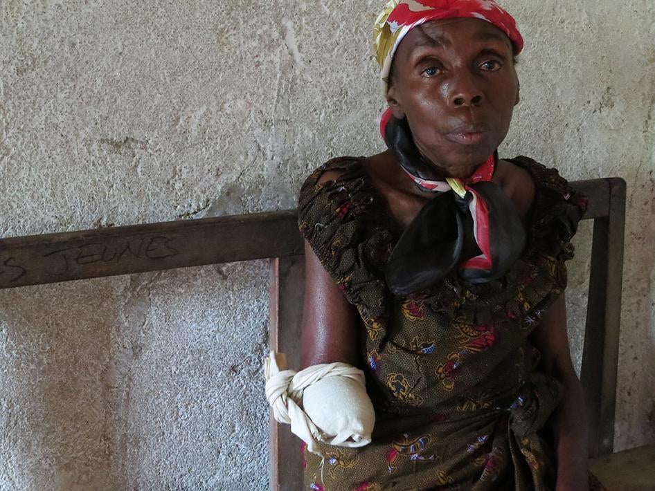 Une femme de 50 ans dont le bras a été sectionné par des combattants des FDLR lorsqu’ils ont attaqué son village dans l’est de la RD Congo en mai 2012. Au cours de cette attaque, des combattants des FDLR armés de machettes ont tué sa fille, son fils, sa b