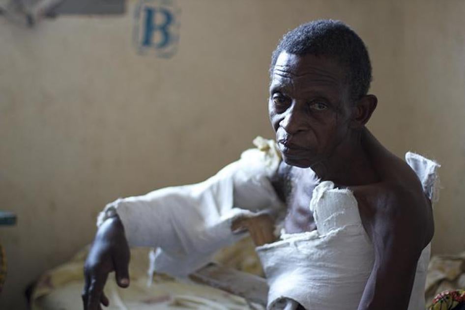 巴鲁古・韦兹瓦洛（Paluku Waitswalo），65岁，2014年10月6日在刚果民主共和国北基伍省梅莫亚村附近遭不明战斗人员以砍刀攻击。