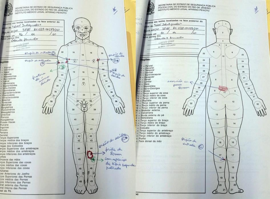 Caio Abílio Fulgencio’s autopsy shows he suffered one shot in the back of the leg (marked “C”) that left an 8-centimeter hole as it exited, and two shots close to each other, one on the left arm (marked “A”) and another on the top right side of his torso 