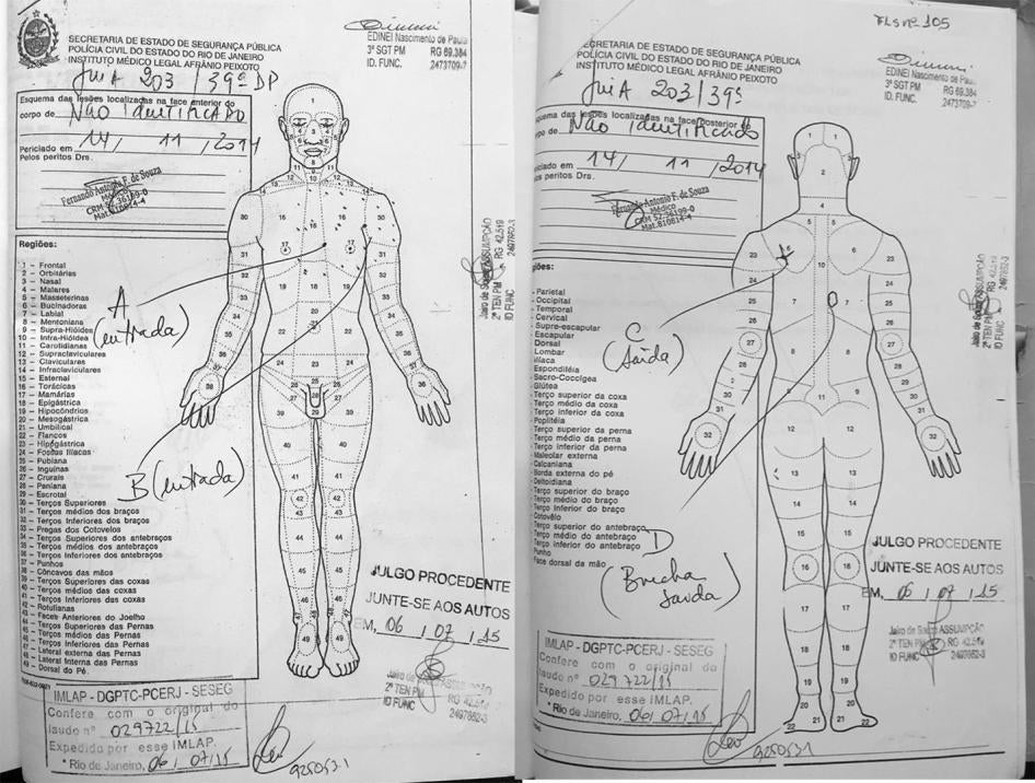 Os diagramas da autópsia de Charles Alves Duarte mostram duas feridas de entrada de bala: no centro do peito (marcada por “A”) e no lado esquerdo do peito (marcada por “B”) com orlas de tatuagem, indicando que os tiros foram disparados à queima roupa. O f