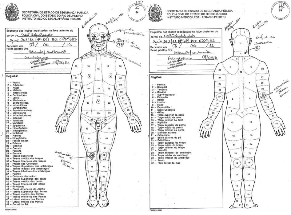 The autopsy diagrams in the case of Jackson Lessa dos Santos show an entry wound (marked “A”) caused by a bullet that entered from the the nape of the neck, and exited through the face, opening a 2-centimeter hole. The entry wound had an abrasion ring, in