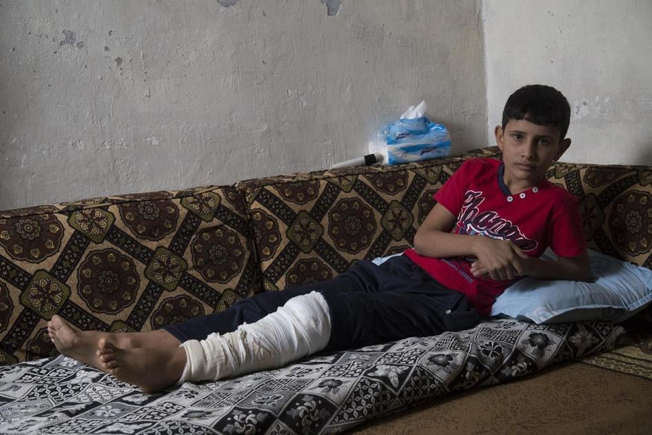 Adnan, 12, whose leg was broken when an explosive device detonated as he was trying to flee from ISIS-controlled territory in early August. 