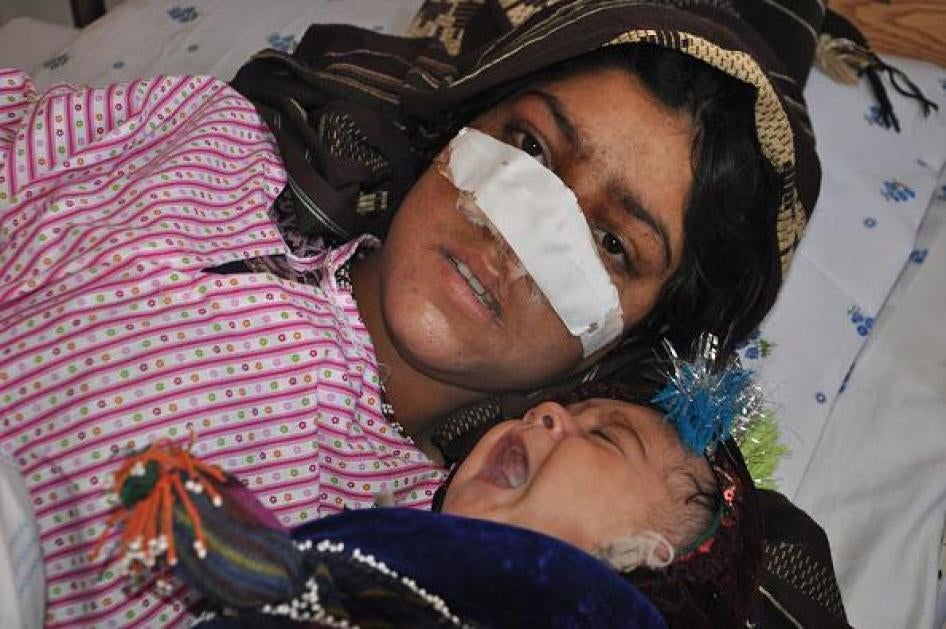 Afghan woman Raiza Gul, 20, and whose nose was sliced off by her husband in an attack, lies on a bed with her baby as she receives treatment at a hospital in the northern province of Faryab on January 19, 2016.