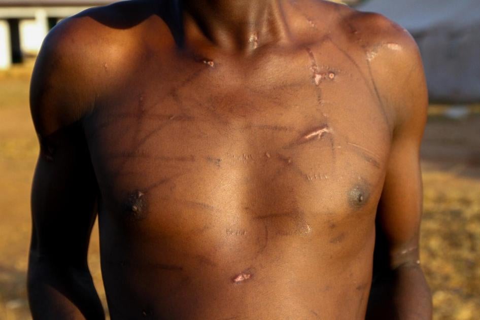 "Claude,” 21, said 3R rebel group fighters tortured him in De Gaulle, in the Koui sub-prefecture of the Ouham Pendé province, Central African Republic, after the group seized the town in late September.  