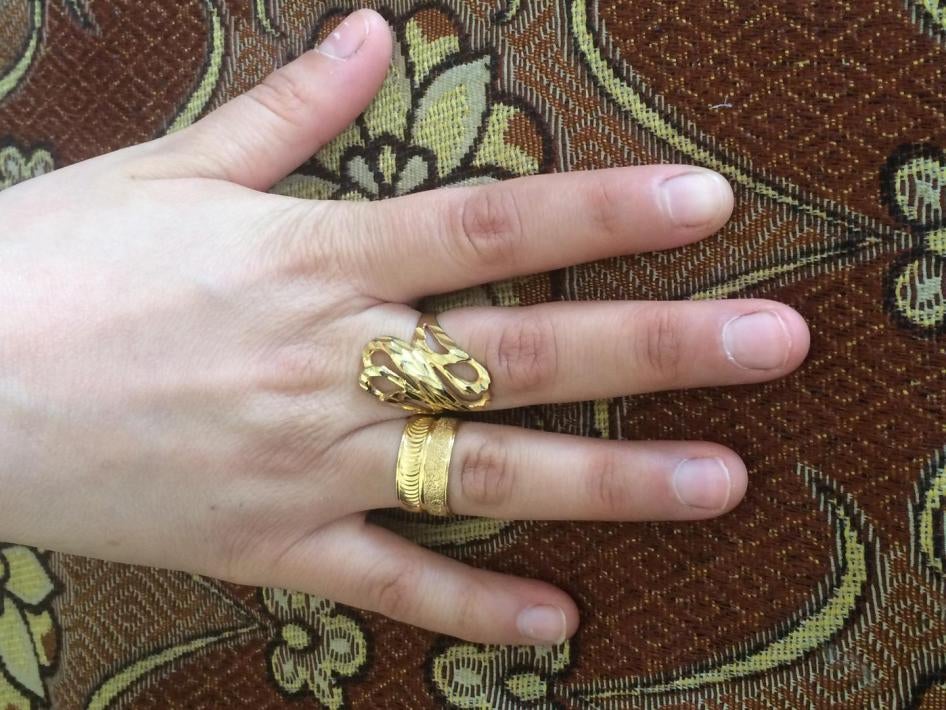 A 15-year-old girl from Ghouta, Syria, shows her engagement ring in Amman, Jordan, where she dropped out of grade 7. Rates of early marriage have increased fourfold among Syrian refugee girls in Jordan since 2011.