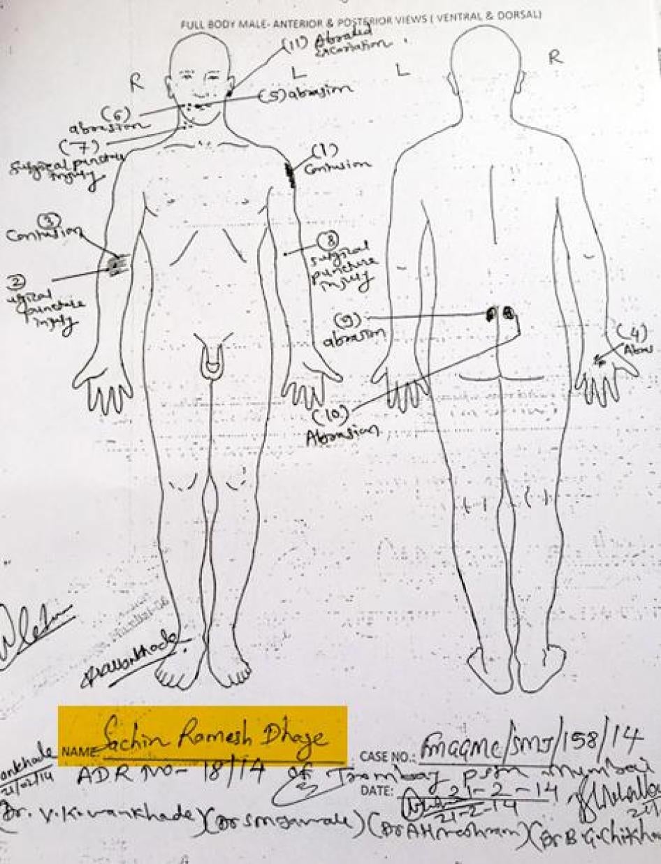 Copy of post-mortem report of Sachin Dhage, February 21, 2014.