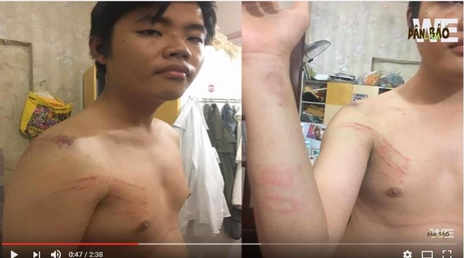 Trần Hoàng Phúc sau khi bị hành hung ở Quảng Bình ngày 13 tháng Tư năm 2017. Ảnh cắt từ một đoạn video trên YouTube của Dân Làm Báo.