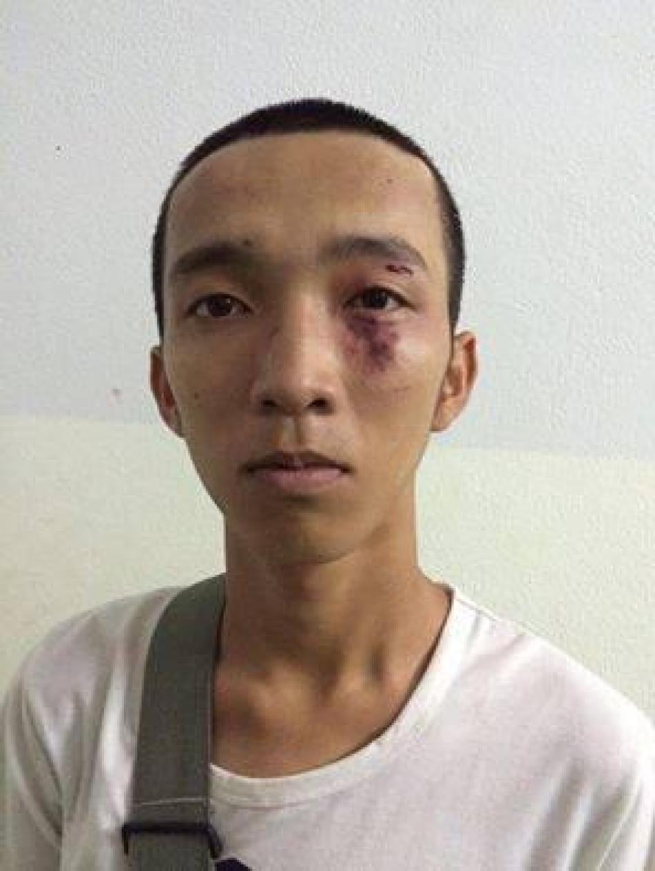 Huỳnh Thành Phát sau khi bị hành hung ở Thành phố Hồ Chí Minh ngày 10 tháng Năm năm 2016. 