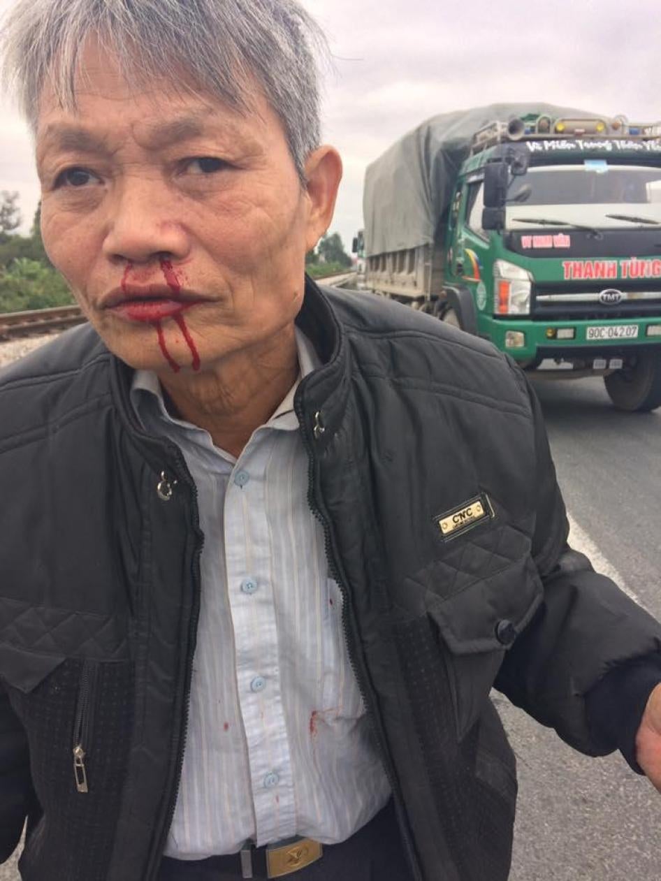 Trương Minh Hưởng sau khi bị hành hung ở Hà Nam ngày 22 tháng Mười hai năm 2016.