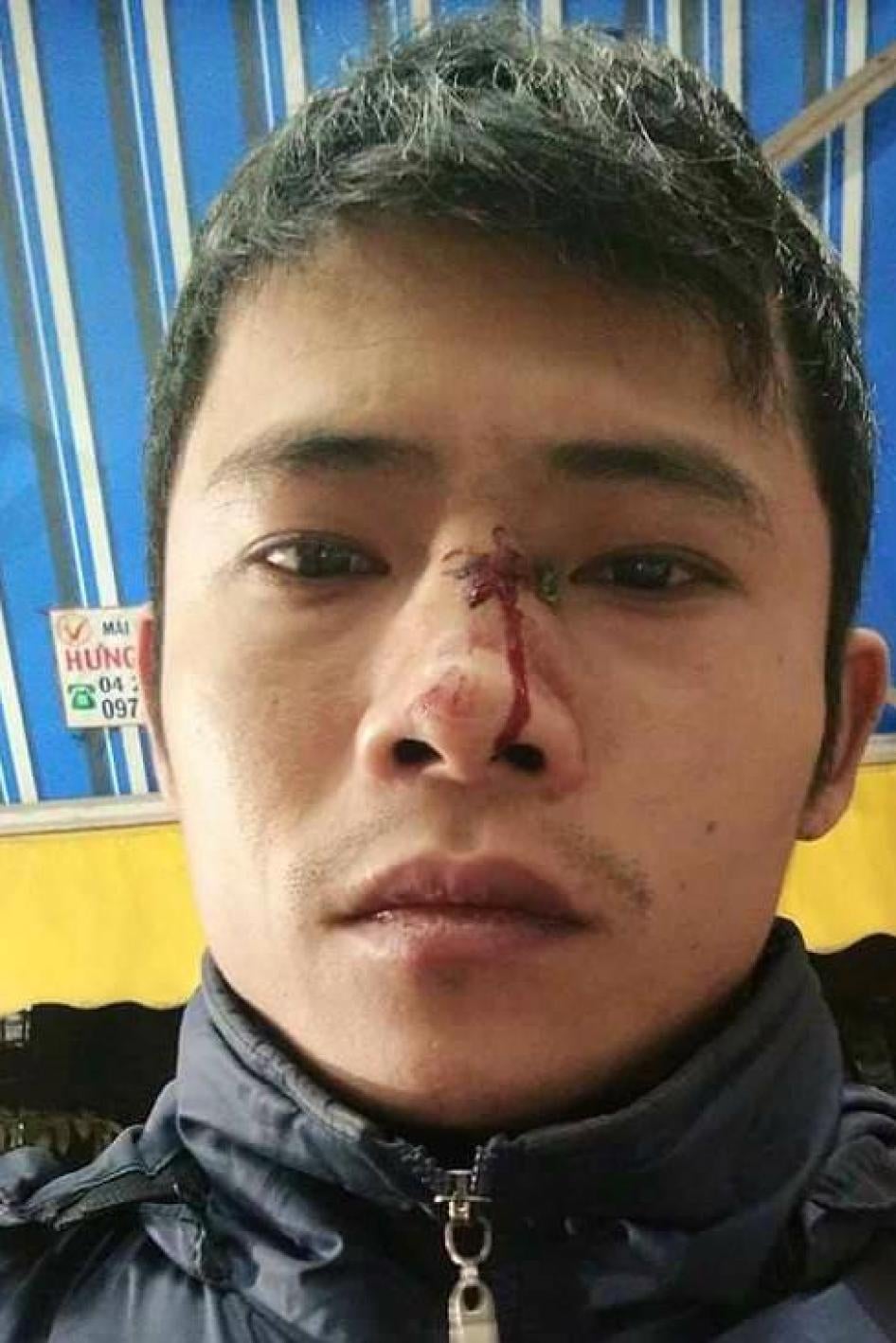 Dinh Hong Quyen after being assaulted in Ha Dong on December 2, 2016.