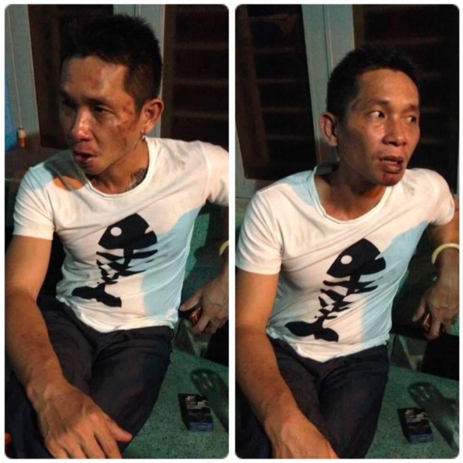 Do Duc Hop after being attacked in Ho Chi Minh City on May 8, 2016. 