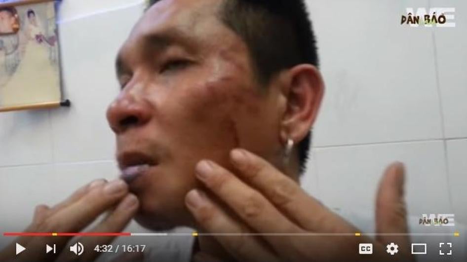 Do Duc Hop after being attacked in Ho Chi Minh City on May 8, 2016.