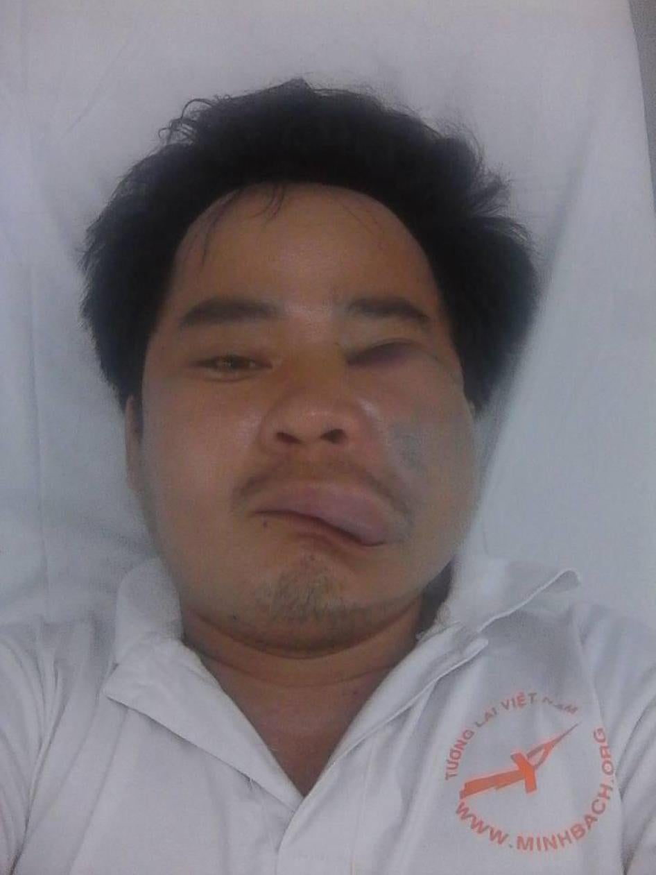 Nguyễn Văn Thạnh sau khi bị tấn công ở Đà Nẵng ngày mồng 5 tháng Sáu năm 2016.