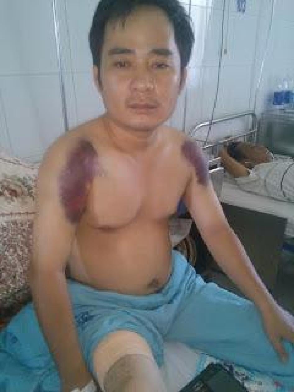 Nguyễn Văn Thạnh sau khi bị hành hung ở Đà Nẵng ngày mồng 4 tháng Tám năm 2015.