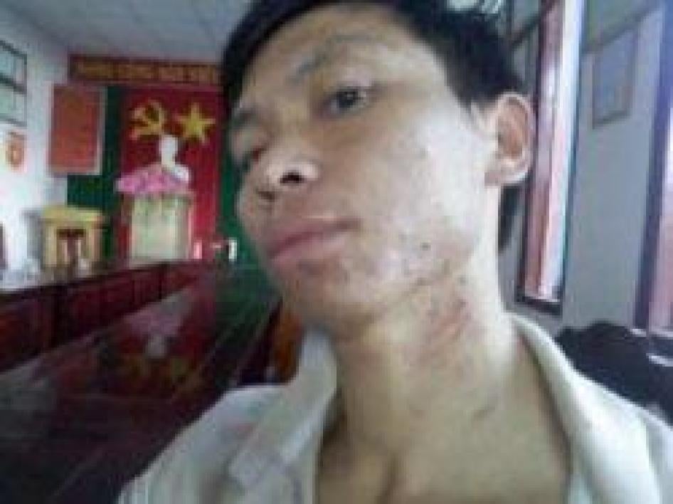 Trần Minh Nhật sau khi bị hành hung ở Lâm Đồng ngày mồng 8 tháng Mười một năm 2015.