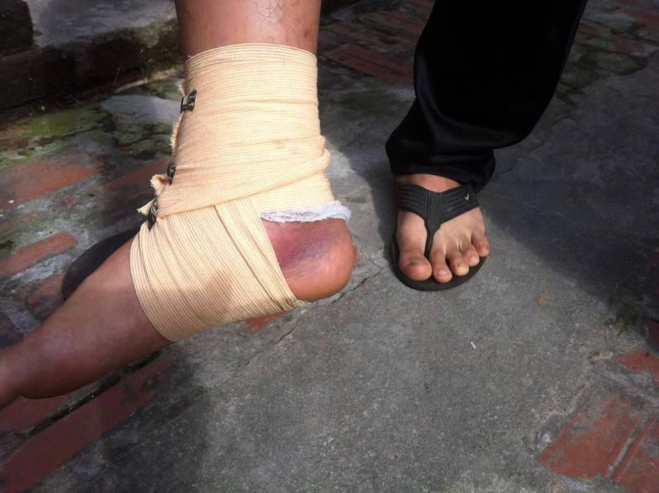 Chân của Lý Quang Sơn sau khi bị hành hung ở Nghệ An ngày mồng 6 tháng Mười hai năm 2015.