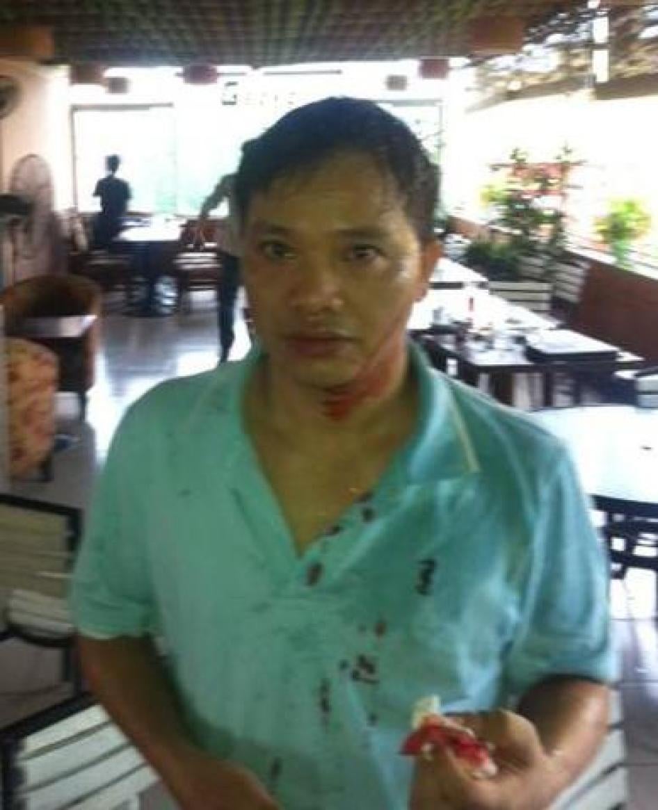 Nguyễn Văn Đài sau khi bị hành hung ở Hà Nội ngày mồng 8 tháng Năm năm 2014.