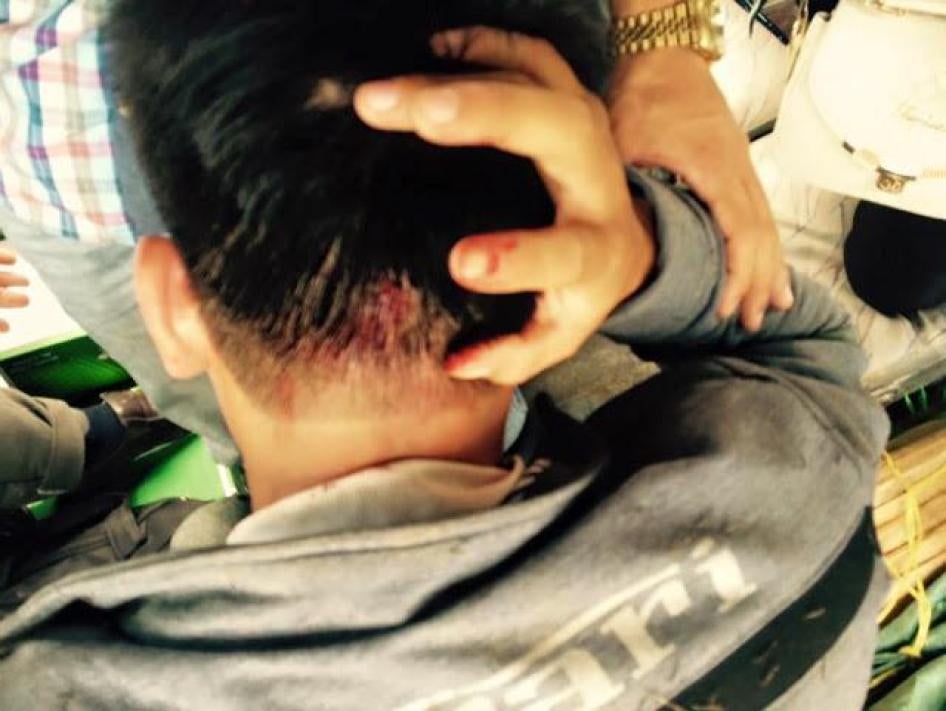 Chu Manh Son after being assaulted in Lam Dong on August 28, 2015.