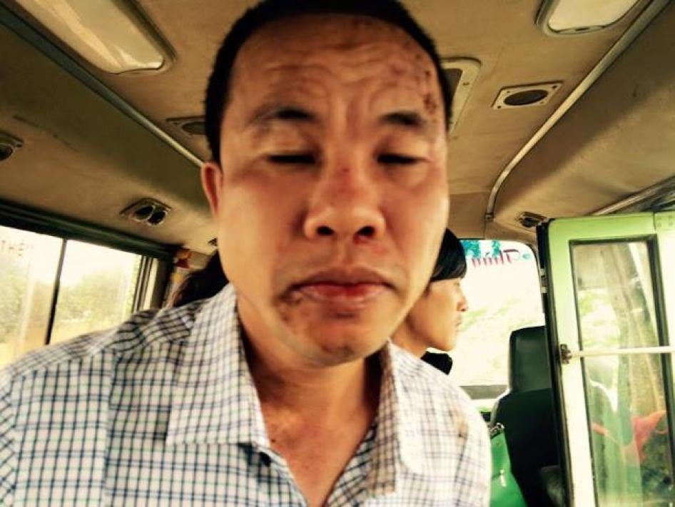 Trương Minh Tam sau khi bị hành hung ở Lâm Đồng ngày 28 tháng Tám năm 2015.