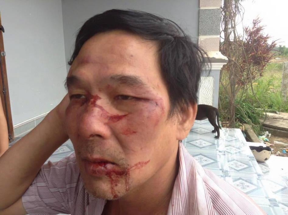 Lê Đình Lượng sau khi bị hành hung ở Lâm Đồng ngày 28 tháng Tám năm 2015.