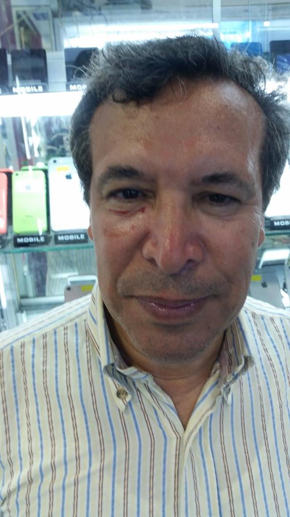 Lawyer Abdelaziz Nouaydi, after a policeman punched him in the face when breaking up a small sit-in in Rabat.