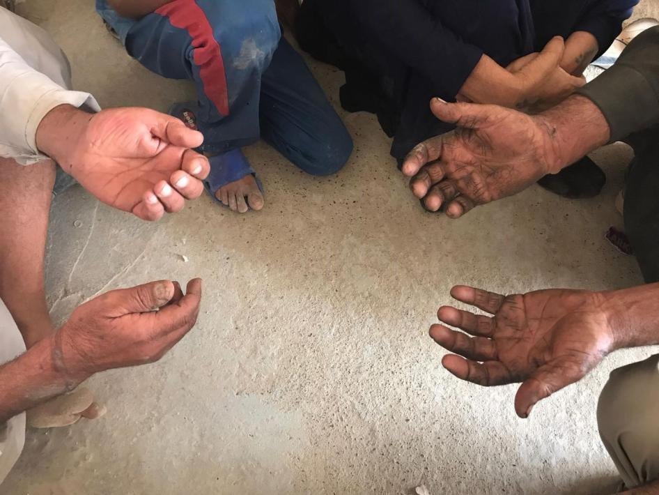 رجلان مسنان من قرية سيحة عثمان يعرضان على الباحثين تقرحات على معصميهما ناتجة عن الأصفاد. 