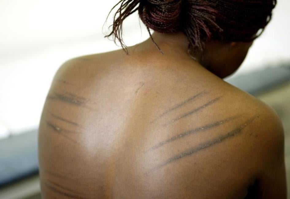 A torture sufferer from Uganda is examined by a doctor at the headquarters of the Medical Foundation for the care of victims of torture in London June 7, 2007. Founded in 1985, the Medical Foundation for the Care of Victims of Torture provides care and re