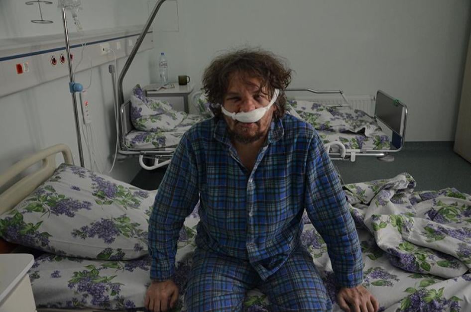 Andrei Rudomakha berdiam di rumah sakit sehari setelah penyerangan, Krasnodar, Russia, 29 Desember 2017.  