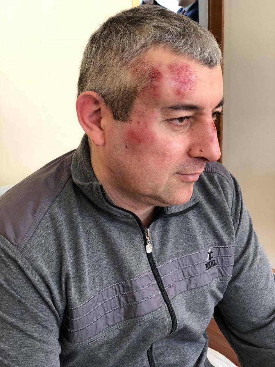 Сиражутдин Дациев после нападения, 28 марта 2018 г.
