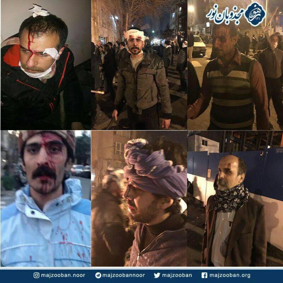متظاهرون من أتباع طريقة الدراويش مصابون بجروح بالغة، طهران، إيران، 20 فبراير/شباط 2018. 